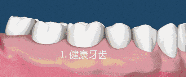 讓口腔清爽、牙齒潔白的利器！最新鬼才設(shè)計(jì)——火爆全球的牙刷！0.18超細(xì)尖毛，25度天鵝頸，牙縫殘?jiān)?、污垢一掃而光? src=